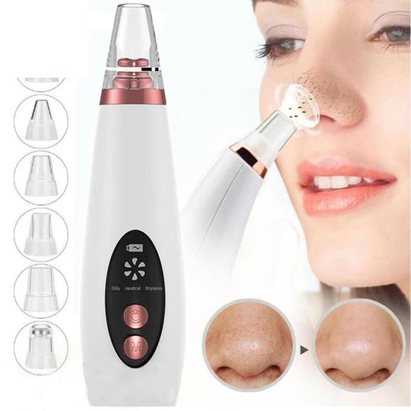 Multi-Functional Blackhead Remover Vacuum